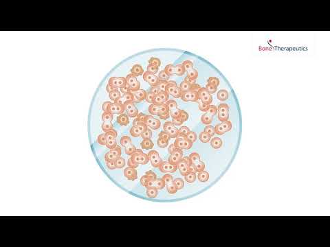 Bone Therapeutics - Regenerative therapies for bone diseases