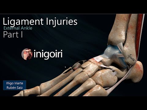 Lateral Ligament Injuries of the Ankle (1) - Ultrasound Evaluation