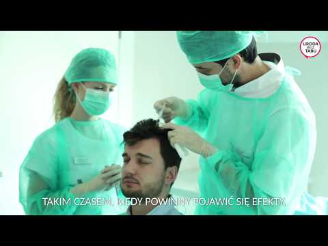 Trental i wypadanie włosów Witaminy dla włosów łamliwych opinii