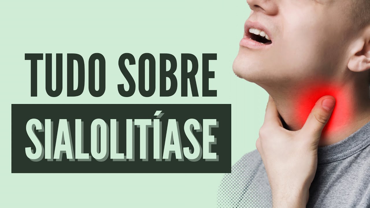 SIALOLITÍASE - A Principal Causa de Inflamação nas Glândulas Salivares