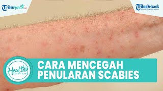 Cara Mencegah Penularan Scabies pada Penderita Diabetes yang Picu Infeksi, Berikut Penjelasannya