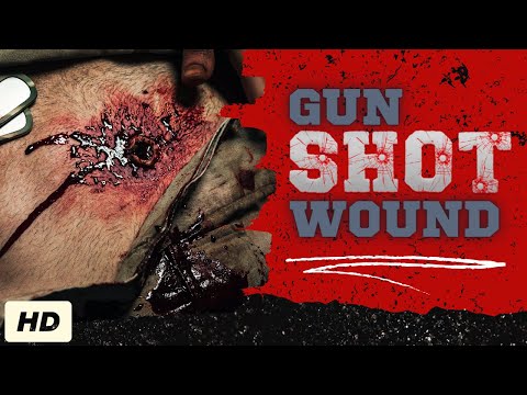 Gunshot Wound: Everything You Need To Know