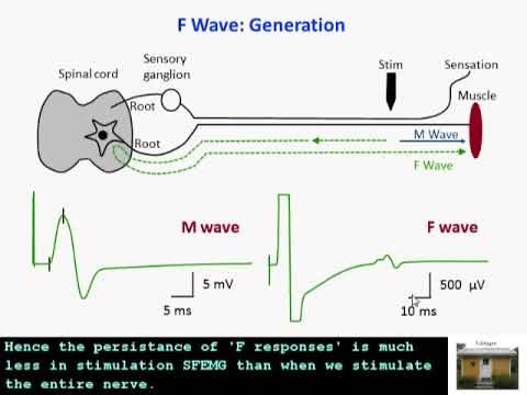 SFEMG - F Response  (Erik Stalberg)