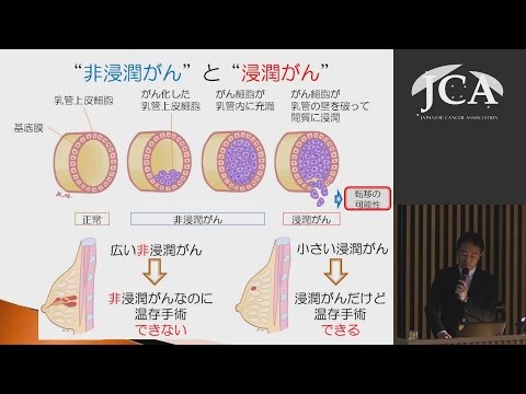 栄養学科 講演２「乳がんの外科治療」　亀井 義明（愛媛大学医学部付属病院乳腺センター　センター長）