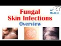 Overview of Fungal Skin Infections | Tinea Infections