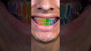 My Custom Grillz with @johnnydangandco