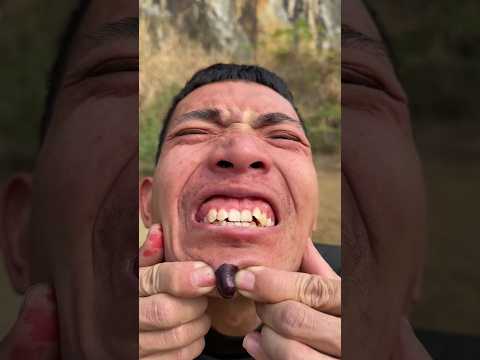 How I Cured a Bug Bite with Yogurt in theWild |Survival Hacks#shorts #4605 😵😱🤔😄