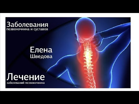 Боль в локтевом суставе при разгибании лечение Массаж остеохондроз атырау