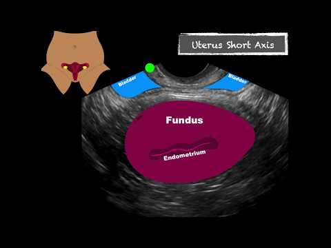 Female Pelvis Transvaginal Scanning Sequence