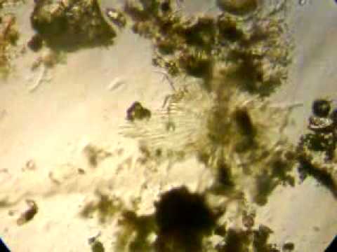 Parazita fonálférgek emberben: tünetek és kezelés - Férgek - Korbféreg élőhely