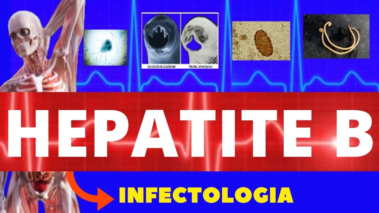 HEPATITE B - CARACTERÍSTICAS, SINTOMAS, DIAGNÓSTICO E TRATAMENTO - INFECTOLOGIA