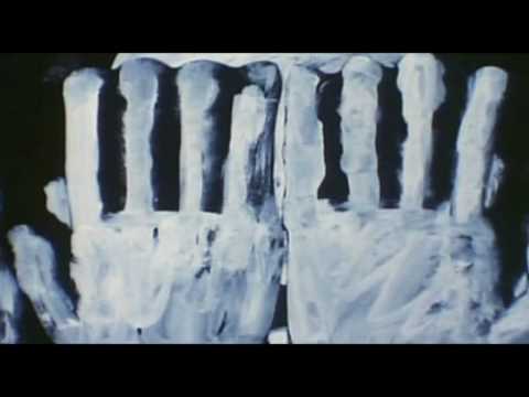 Wynardtage - Sterbehilfe