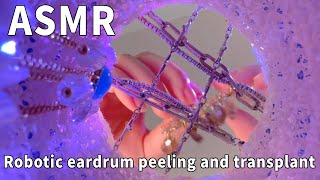 Robotic eardrum removal and re-implantation! Homey Repair Shop ~ Super comfortable eardrum scraping