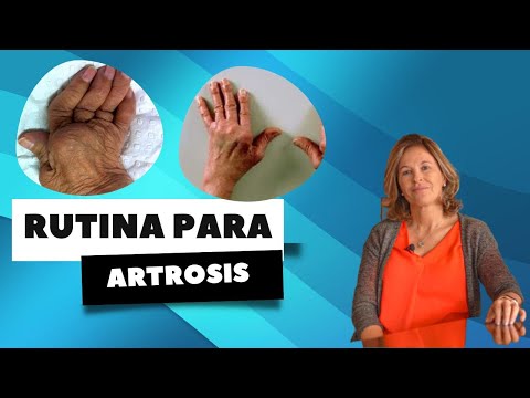 RUTINA PARA ARTROSIS DE MANOS