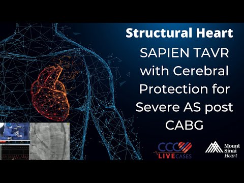 SAPIEN TAVR with Cerebral Protection for Severe AS post CABG