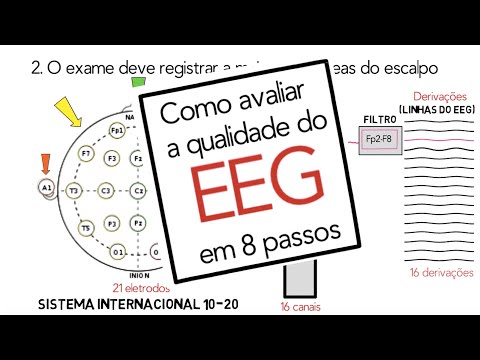 Como avaliar se o EEG é de boa qualidade?