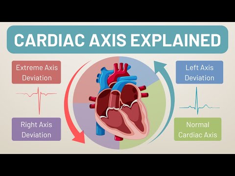 How to Calculate Cardiac Axis | ECG Interpretation
