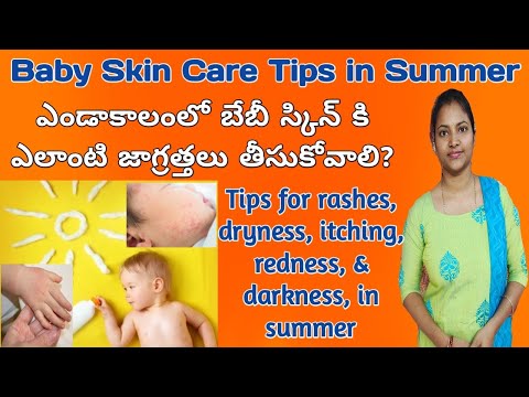 Skin care tips for babies in summer || Baby skin care tips in summer || summer care tips