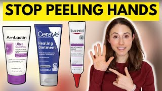 How to STOP SKIN PEELING ON THE HANDS & FEET 🤔 Dermatologist @DrDrayzday