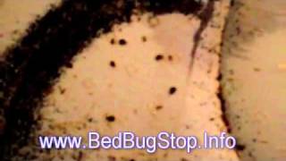 Bed Bug King NYC - Shocking & Disgusting!