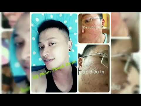 Thanh Dươc Tri Mụn PV 2
