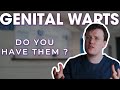 Best Over The Counter Medicine For Genital Warts