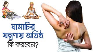 ঘামাচির যন্ত্রণায় অতিষ্ঠ, কি করবেন? | How to get Rid from Prickly Heat Rash