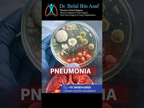 🚨 TB ka doubt hai? Pehle yeh 1 baat samajh lo warna late ho jayega!