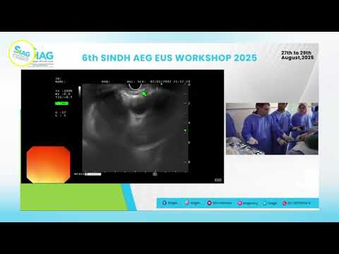 AEG -EUS workshop || 2025 At Siag civil hospital Karachi part 7
