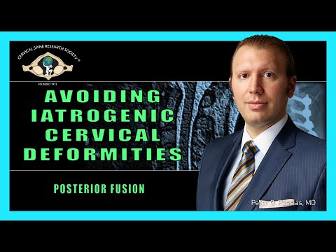 Avoiding Iatrogenic Deformities: Posterior Fusion
