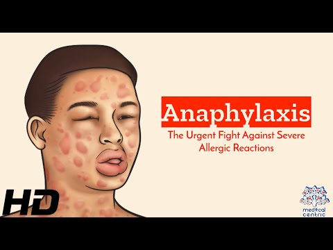 Wheat Allergy Causes Signs and Symptoms Diagnosis and Treatment