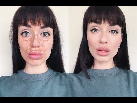 Пигментные пятна на икрах ног Причины пигментных пятен на лице у мужчин