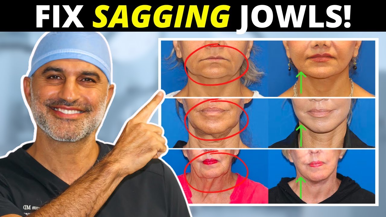 Sagging Jowls 101: How they form and what to do about them! (tighten and eliminate!)
