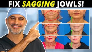 Sagging Jowls 101: How they form and what to do about them! (tighten and eliminate!)
