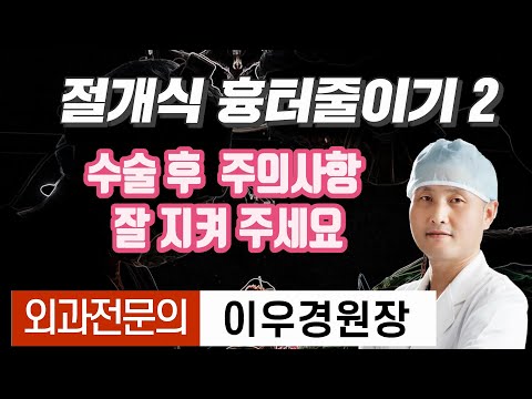可减少植发疤痕。 Root院长外科专门医生李宇京院长介绍患者的疤痕管理。