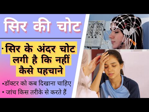 सिर की चोट  | सिर के अंदर चोट लगी है कि नहीं कैसे पहचाने | SELF DOCTOR