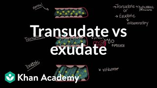 Transudate vs exudate | Respiratory system diseases | NCLEX-RN | Khan Academy