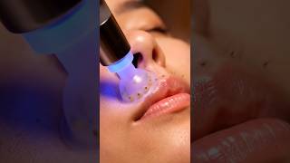 Deep Suction Blackhead Removal | Realistic ASMR Skincare