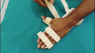 Cock-Up Wrist Splint