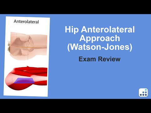 Hip Anterolateral Approach (Watson-Jones) Exam Review - Doug Padgett, MD