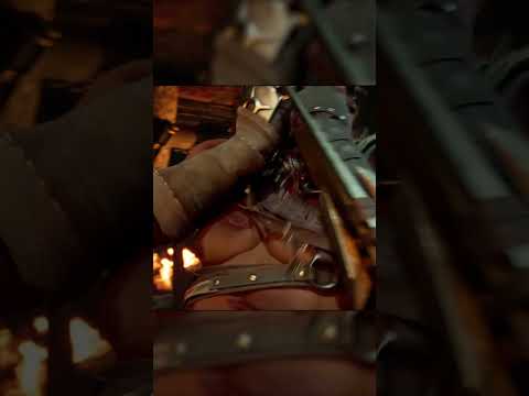 Havik Burning Face!!