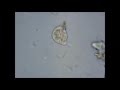 Tiny Amoeba