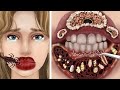 ASMR｜Remove parasites from camper's mouth！Trypophobia cautious entry!기생충 감염 치료