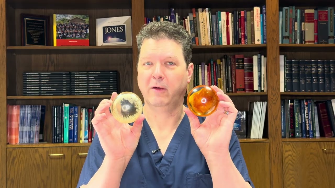 Doctor demonstrating cataract models, one clear and one amber, in front of a bookshelf with eye care resources, related to educational video on cataracts.