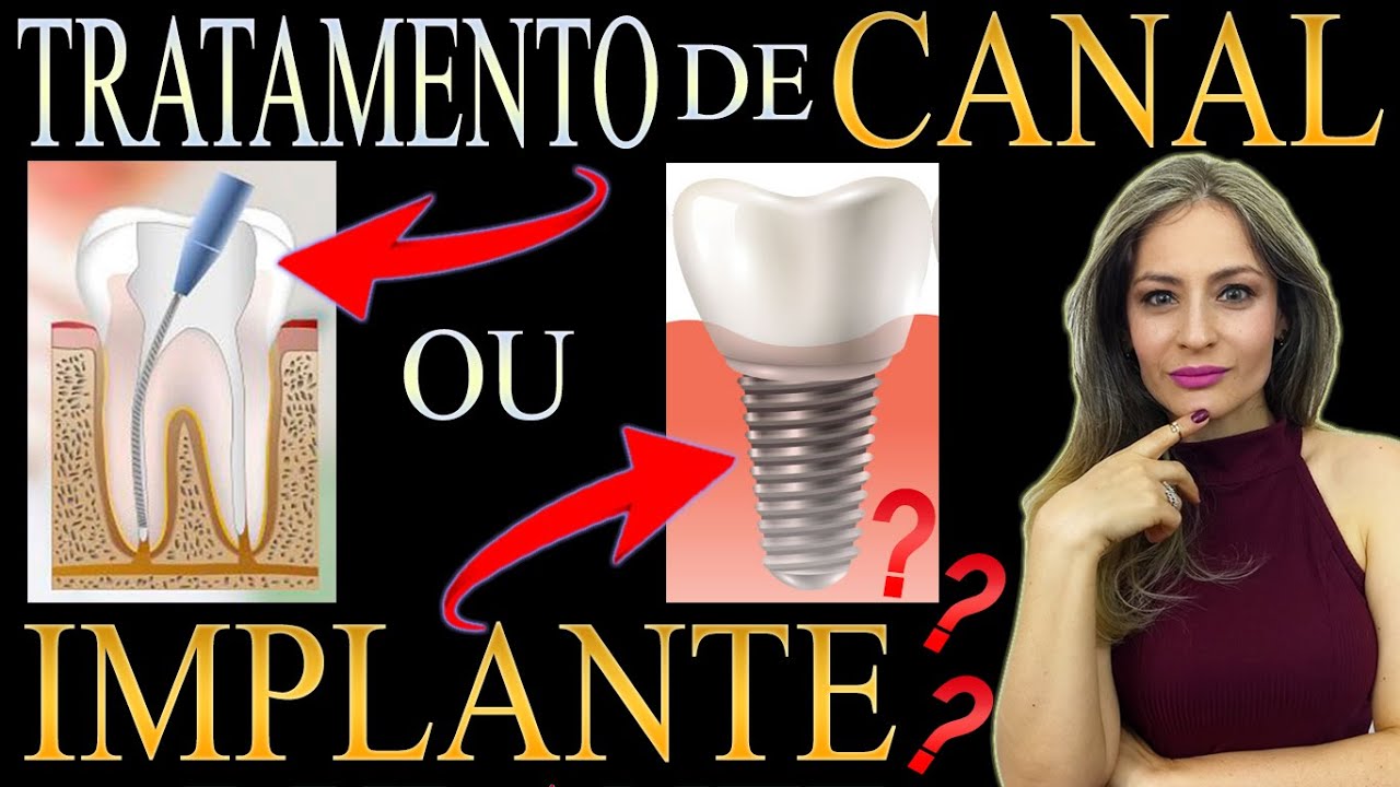 What is better to treat CANAL OR TO EXTRACT THE TOOTH AND IMPLANT? Find out what's best for you...