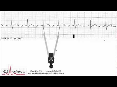 ECG Interpretation Basic Level - Part 5