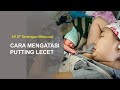 Konseling Menyusui Seri MI 3F Cara Menangani Puting Lecet
