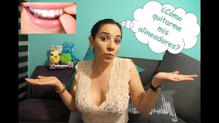 Moons Tips / ¿Cómo quitarme mis alineadores