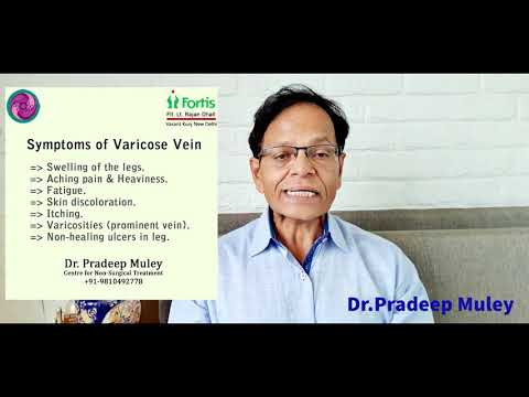 Best treatment option for varicose vein