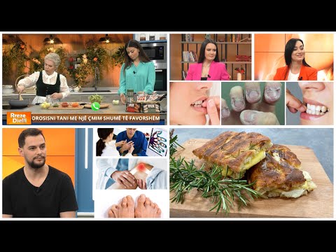 Rreze Dielli - Emisioni 12 Prill 2023, Receta tradite/Artriti i duarve dhe gjurit /Ngrënia e thonjve